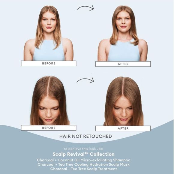 Briogeo Scalp Revival Soothe + Detoxify Travel Set 🚿 NEW Charcoal - Picture 4 of 8